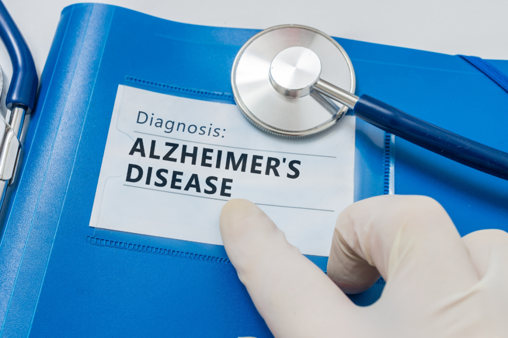 NYCU’s Mathematical Model Advances Early Alzheimer’s Detection